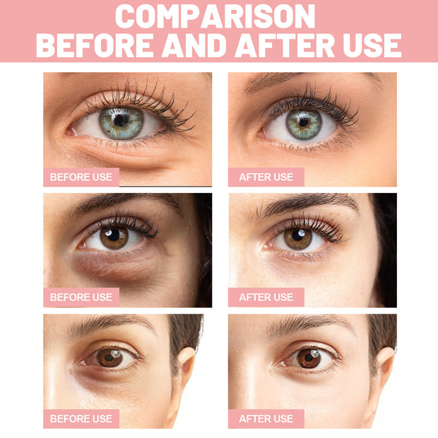 Rose Eye Mask Patches (60 Count)