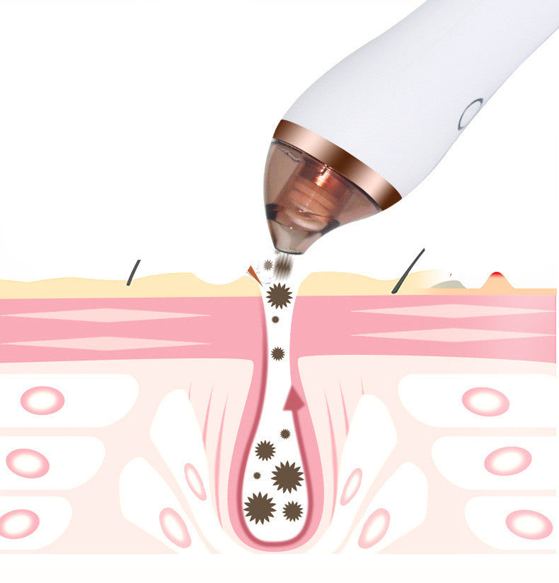 Facial Blackhead Remover