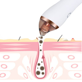 Facial Blackhead Remover