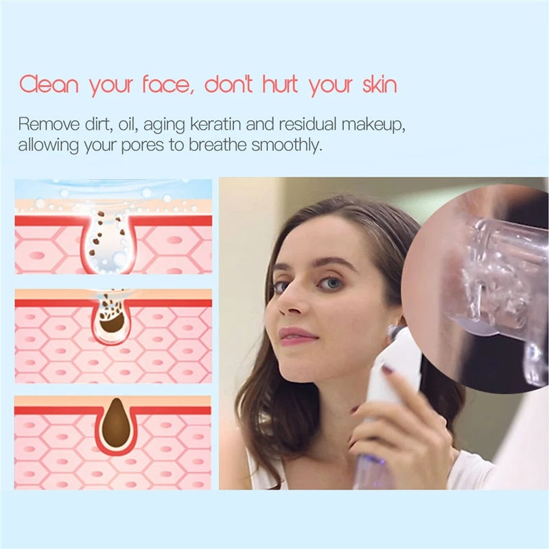 Hydrating Face Cleaning & Peeling Vacuum